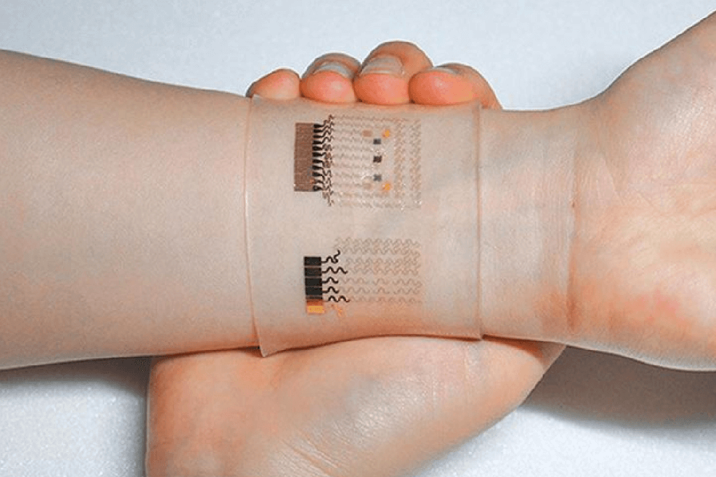 wearable technology and it’s past, present and future- healthcare industry-gkmit